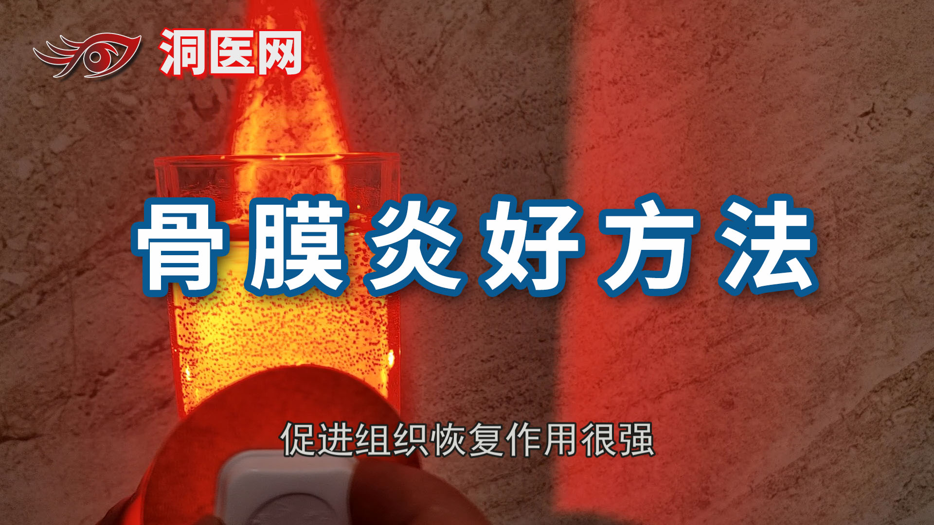 严重骨膜炎该怎么治疗_洞医网