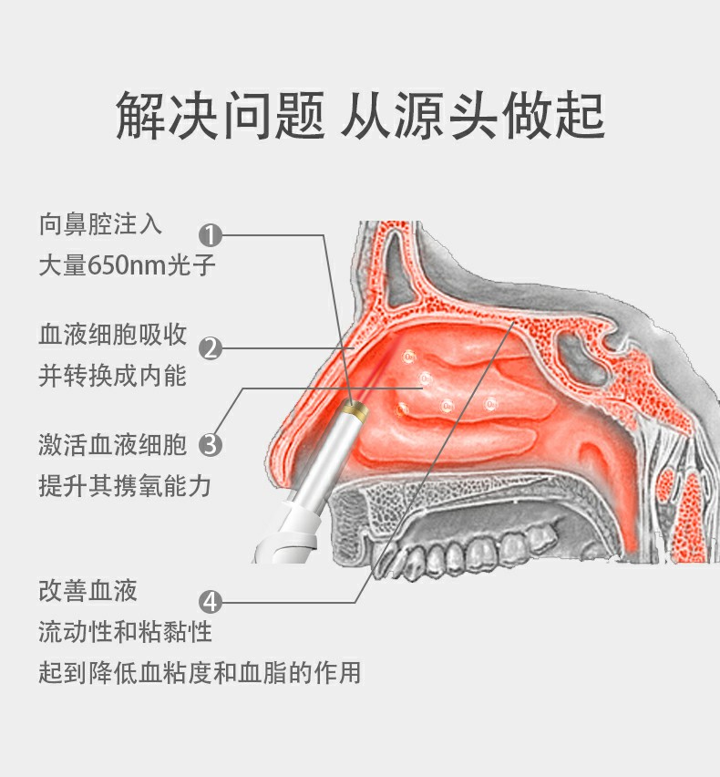 鼻炎治疗_鼻炎激光治疗仪_光盾治疗鼻炎有用吗