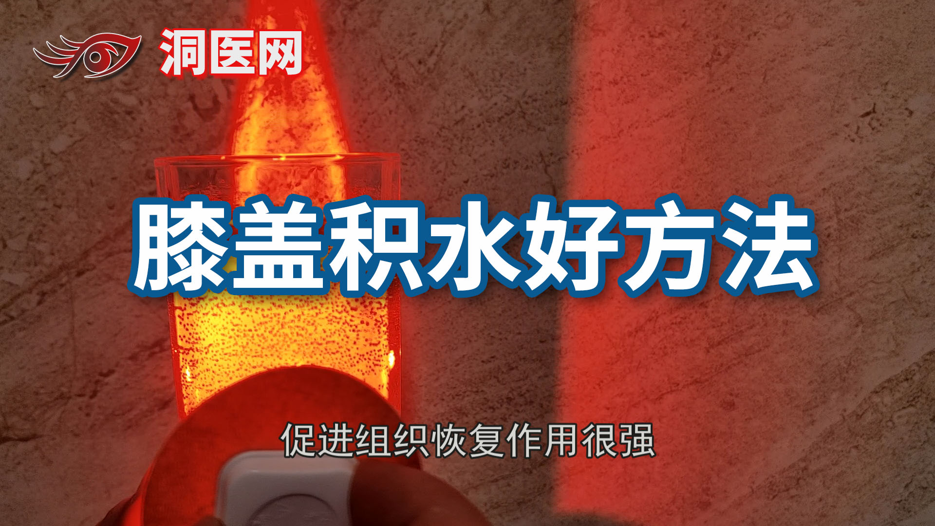  膝关节腔及髌骨囊少量积液_洞医网